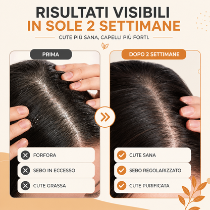 Shampoo solido per capelli Grassi