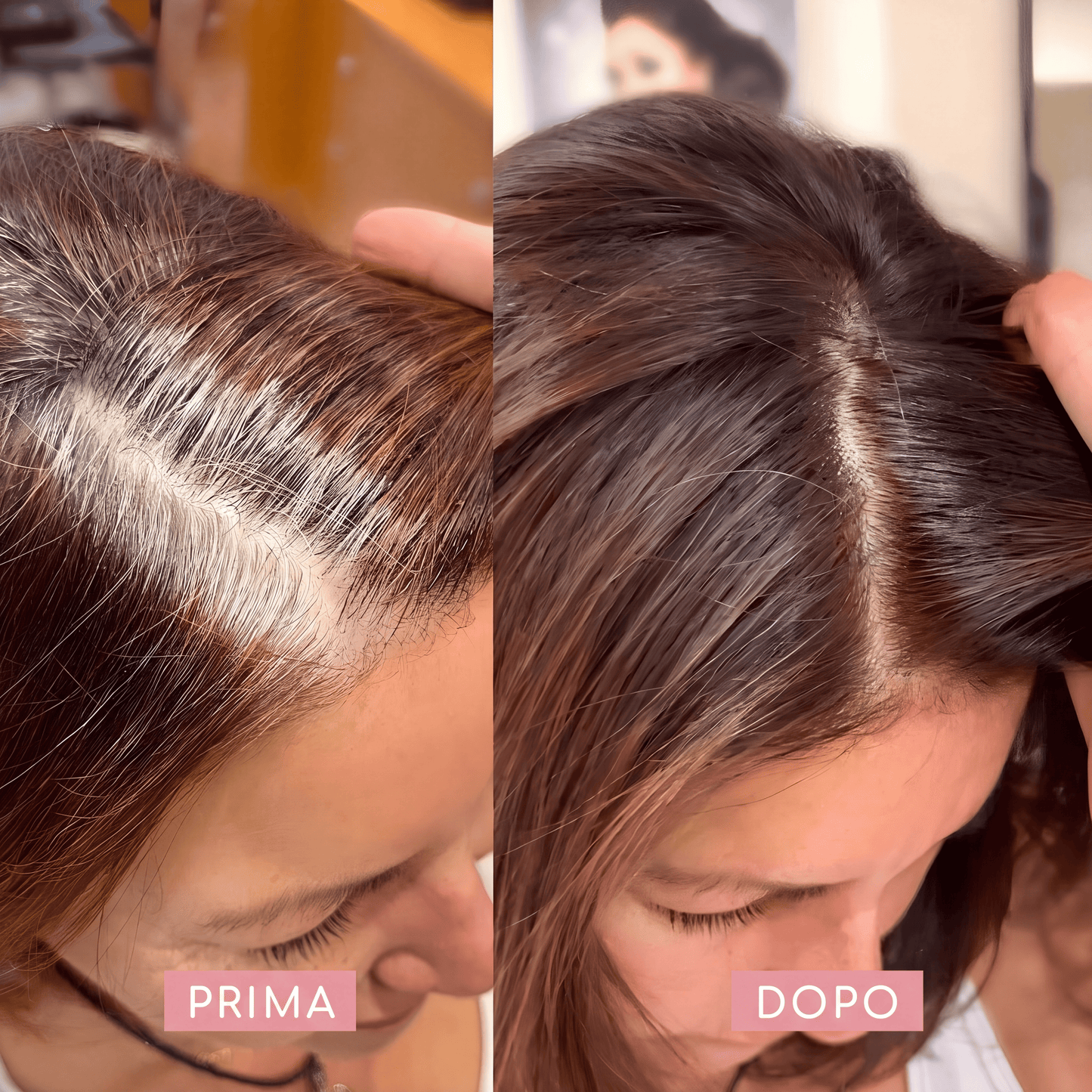 Omelia™ — Kit Copri-Radici e Ricrescita